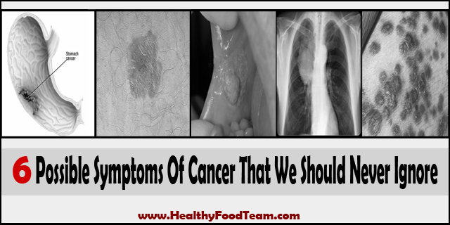 6 Possible Symptoms Of Cancer That We Should Never Ignore1