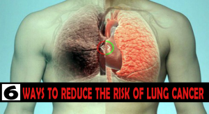 6 Ways To Reduce The Risk Of Lung Cancer image-2305
