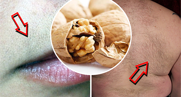 Ancient Recipe Helps Remove Hair From The Face And The Body