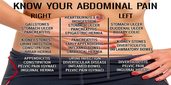 Know-your-Abdominal-Pain-WP