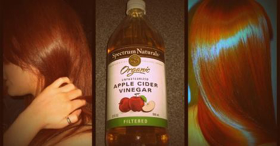 Why You Should Wash Your Hair With Apple Cider Vinegar