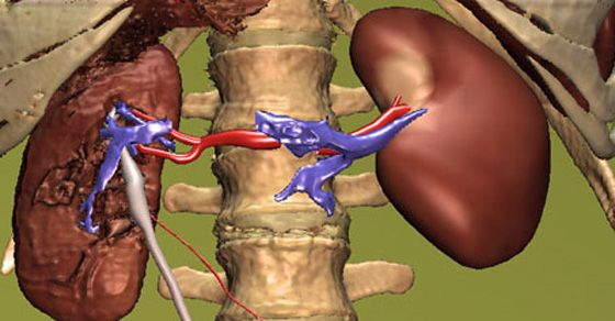 10 Common Habits that Damage Your Kidneys