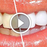How To Whiten Your Teeth in Just 3 Minutes (VIDEO) image-3375