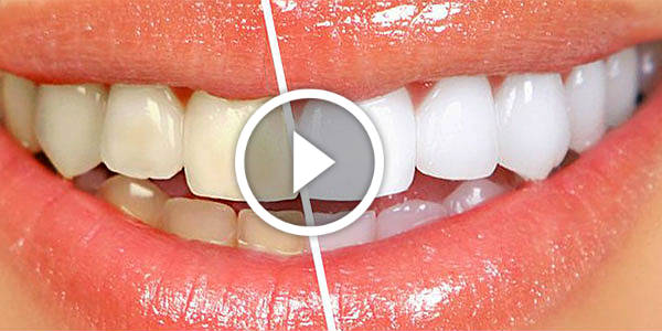 How To Whiten Your Teeth in Just 3 Minutes (VIDEO)