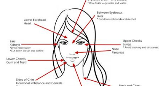 this-is-what-acne-tells-about-your-health
