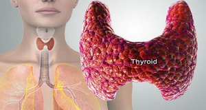 These Are The Symptoms Of Thyroid Malfunction and How To Cure It Naturally image-3590