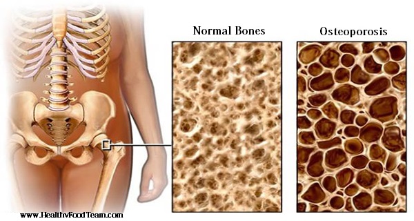 The Three Strongest Bone Guards