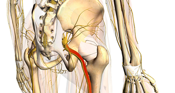 Top 10 Sciatic Pain Natural Treatments
