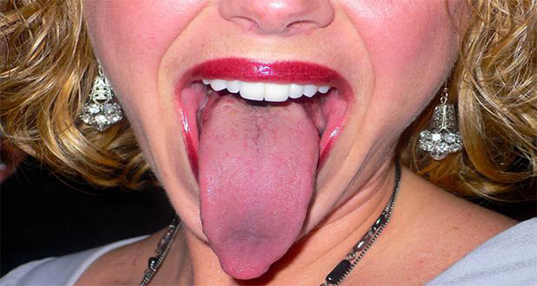Watch The Change Of Your Tongue! Color, layers ... It can Point to Serious Problems