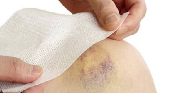 How to Remove Bruise Marks Naturally