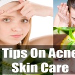 13 Surprising Home Remedies for Acne image-6500