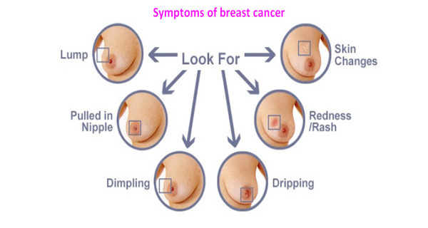 How Can Breast Cancer Be Detected