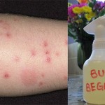 Make Your Own Natural Bug Repellant With This Easy Recipe image-6283