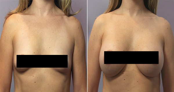 6-Plants-That-Make-Breast-Grow