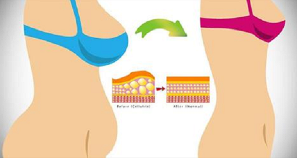 6-Ways-to-Lose-Belly-Fat-Without-ExerciseIn-No-Time