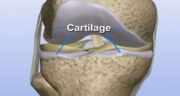 Naturally-Restore-Knee-Cartilages