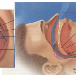 Eliminate Snoring Using These 6 Simple Yet Effective Exercises image-6697