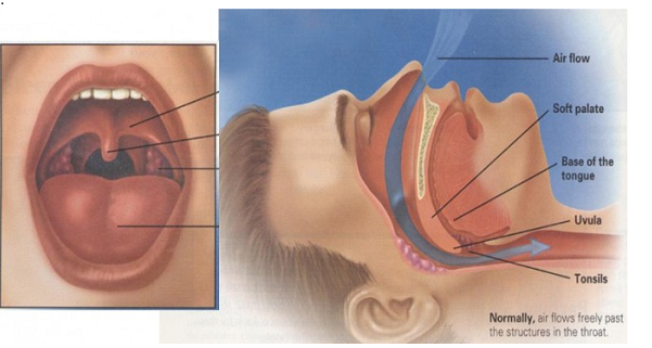 stop-snoring