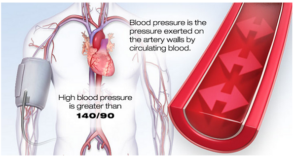 control-blood-preasure