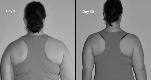 back-fat