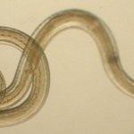 Rid Your Body of Parasites You Didn’t Even Know You Had image-7057