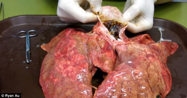 lungs after 60 cigarettes