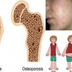 11 Reasons You Need to Stop Drinking Cow’s Milk Immediately image-7218
