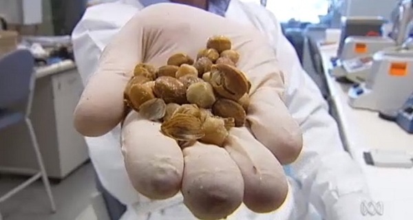 An Incredible Discovery! This Fruit Kills Cancer Only In Several Minutes