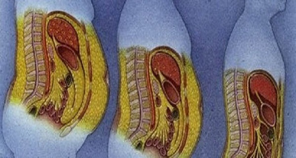 Nutritionists Recommend THIS for Breakfast to People Who Want to Lose Belly Fat!