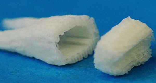 Stem-Cell Dental Implants Grow New Teeth in Your Mouth