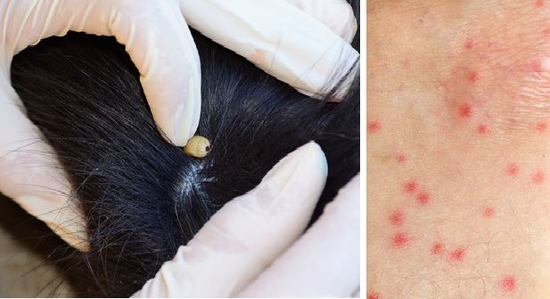 10-Signs-That-Your-Body-is-Full-of-Parasites-And-How-to-Get-Rid-of-Them