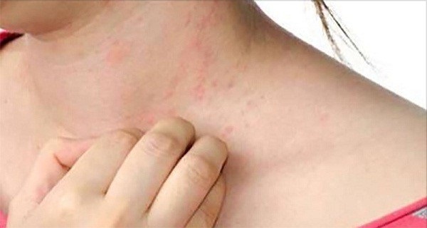 10 Symptoms You May Have Parasites in your Body (and how to remove them)