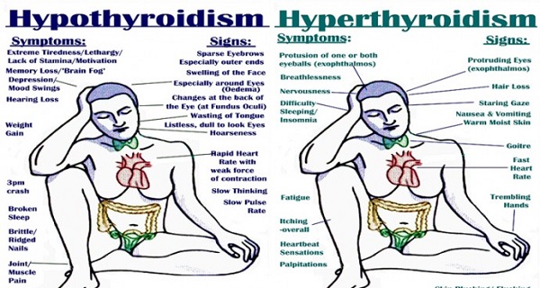 ALL THE SIGNS, SYMPTOMS, TRIGGERS AND TREATMENTS OF HYPO AND HYPERTHYROIDISM