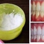 DIY: Natural Tooth Whitening in Minutes at Home image-8510