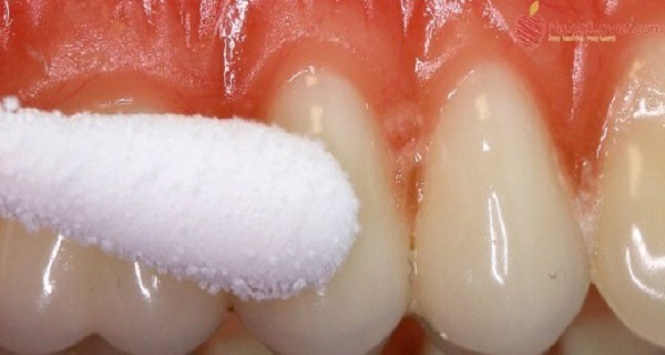 Get Rid of Toothache and Relieve Pain at Home in Just a Few Minutes