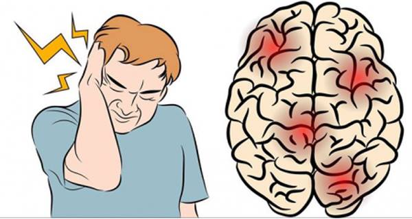 How To Instantly Stop A Migraine With Salt