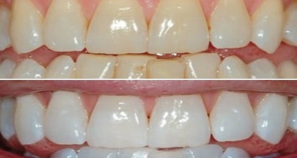 Recipe From Our Grandmothers – Mix Two Ingredients And Let Your Smile GLOW!