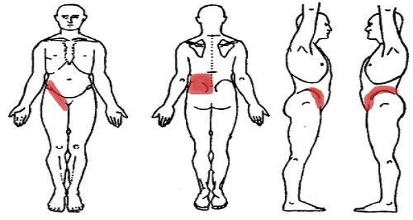 This Common Vitamin Deficiency Triggers Headache, Back Pain and Joint Pain