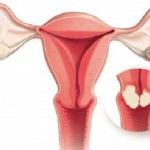 Top 10 Herbs that Can Boost Your Cervical Health! image-8201