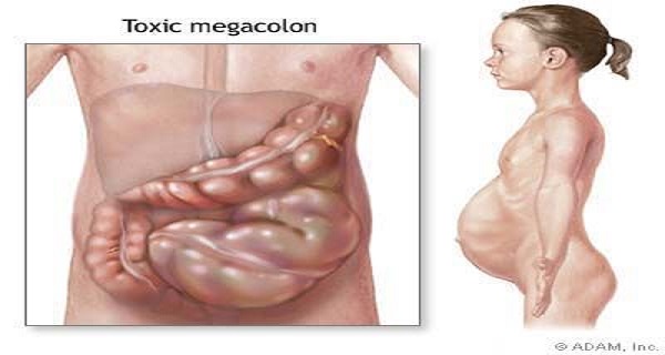 Why You Feel Bloated All the Time (And How to Fix the Problem)