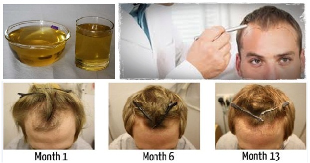 natural-ways-to-regrow-hair-how-to-naturally-regrow-lost-hair-in-15-minutes-a-day-2