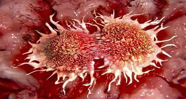 top 10 cancer causes