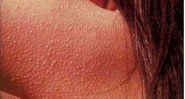 Advice Stop Eating Gluten Immediately if You Can Notice These (2)