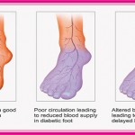 Do You Suffer From Poor Circulation? Here Is How To Solve Your Problem In Just 20 Minutes! image-8690