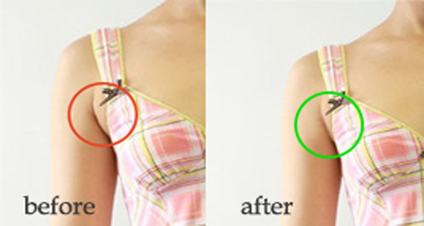 How to Get Rid of Armpits Fat