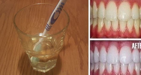 Natural Teeth Whitening With Just One Ingredient (3-Minute Recipe)