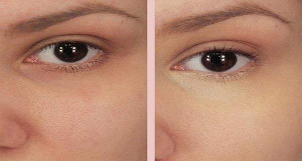 Put Baking Soda Under Your Eyes and the Results Will Be Amazing!