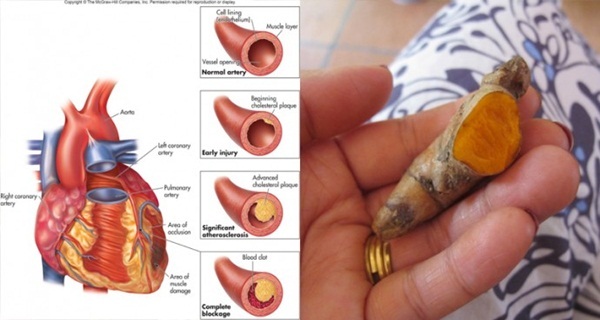 STUDY A Pinch Of Turmeric As Effective As An Hour Of Exercise