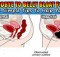 Say Goodbye To Belly Bloat Forever! Here Are 3 Simple Tips To Help You Flatten Your Stomach Starting Today