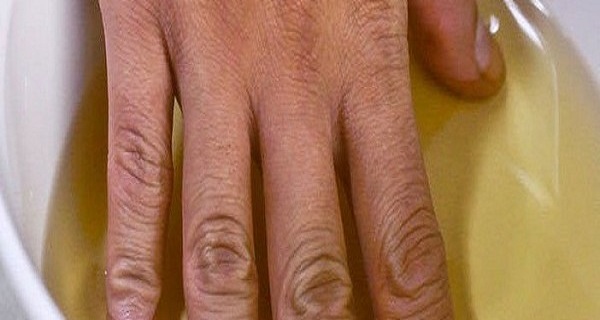 She put her hands in apple cider vinegar twice a week; you will not believe the effect is achieved!